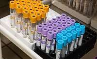 Planning and Executing Label Qualification